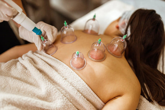 Cupping Therapy (NOT A MASSAGE) (2 - HOUR Cupping Therapy)