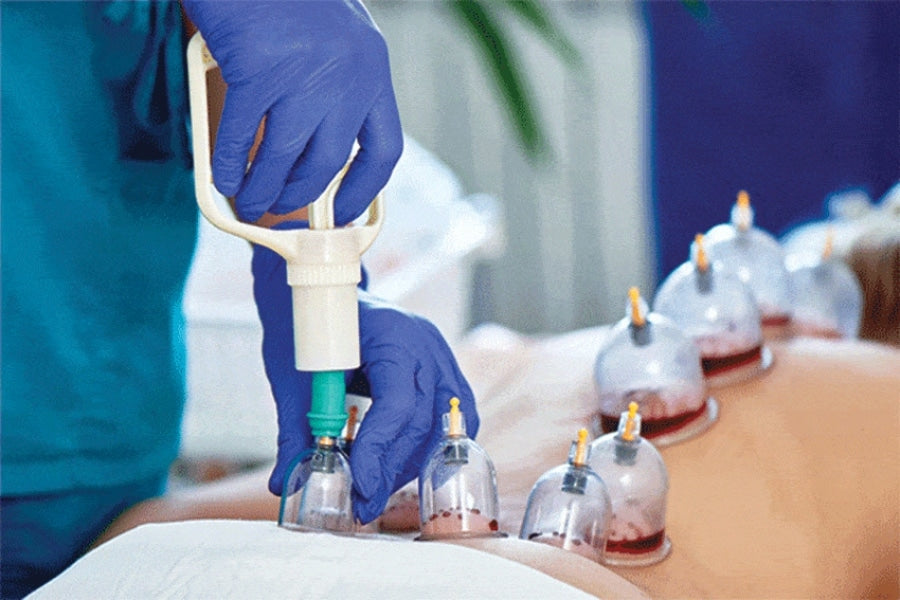 Hijama