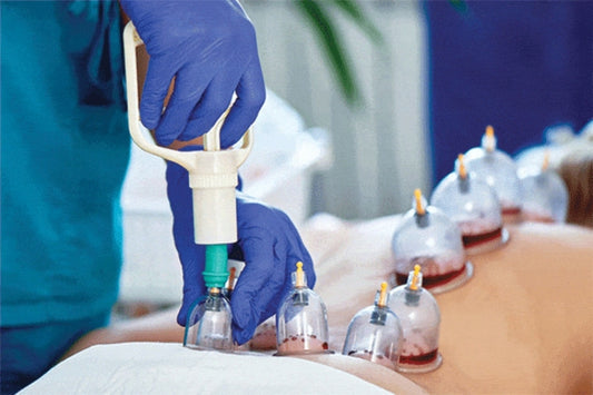 Hijama