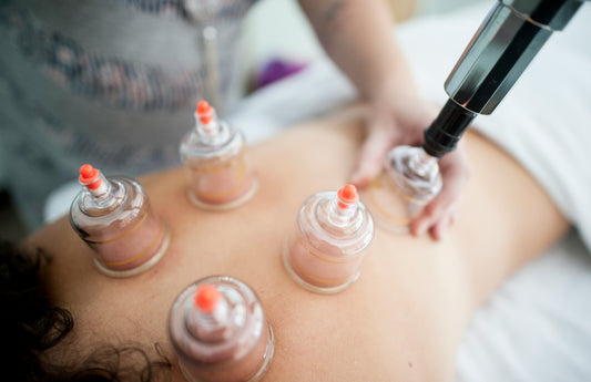 Cupping Therapy Massage (Dry & Wet)